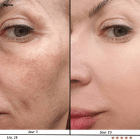 Higlow Peptide Eye Patch - My Store