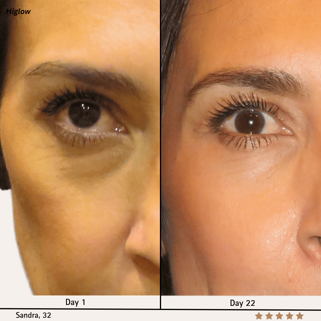 Higlow Peptide Eye Patch - My Store