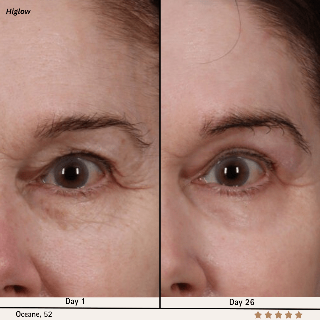 Higlow Retinal Shot - My Store