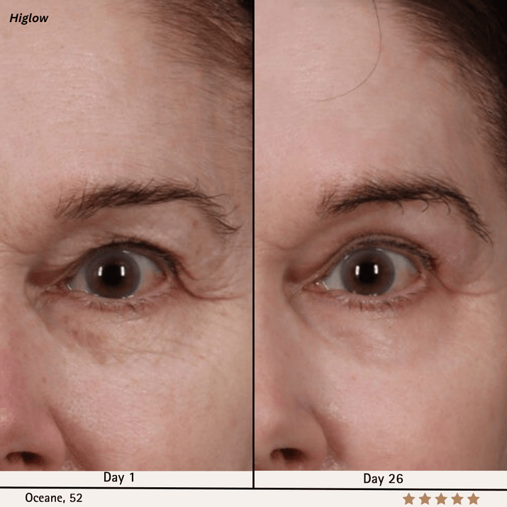 Higlow Retinal Shot - My Store